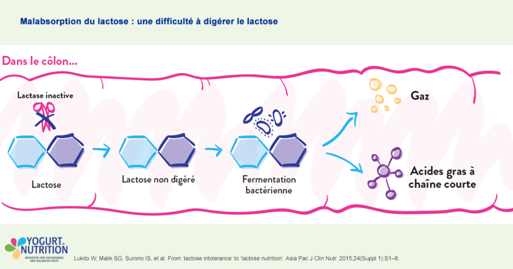 Malabsorption du lactose : une difficulté à digérer le lactose - YINI